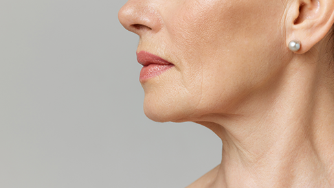 wrinkles_fine_winkles